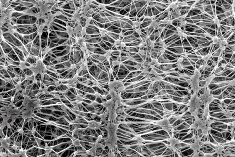 Cos'è la membrana in PTFE?